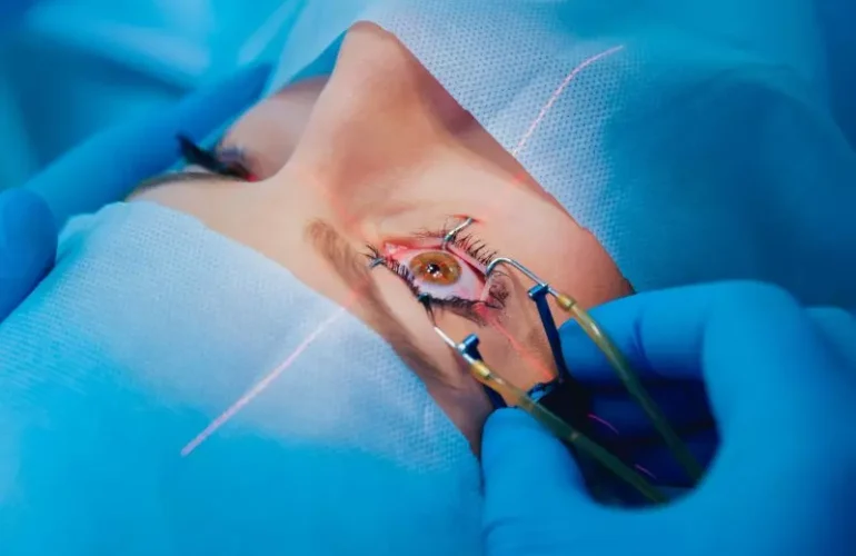 correcao-da-visao-a-laser-um-paciente-e-uma-equipe-de-cirurgioes-na-sala-de-cirurgia-durante-a-cirurgia-oftalmologica-especulo-palpebral-tratamento-de-lasik-800x543